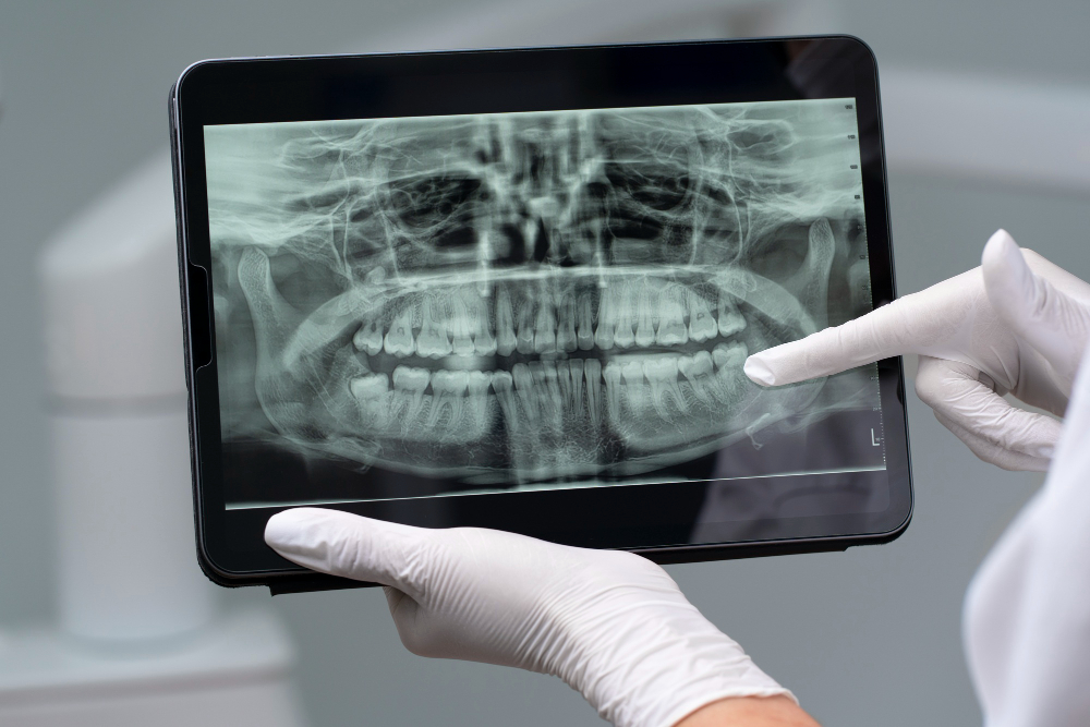 Digital X-Rays in Bella Vista